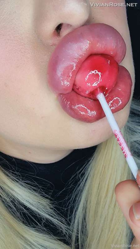 Big lips are so much fun 😍💗💋💉