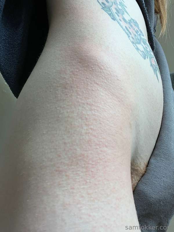 Can I send you coochie pics of my allergic reaction? 🥹🤣 jk i..