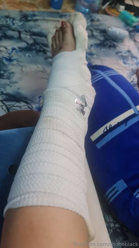 Wanna walk but i can't Last week i went to hospital to check..