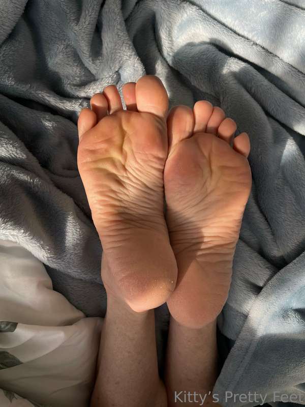 Kissed by sunshine 1