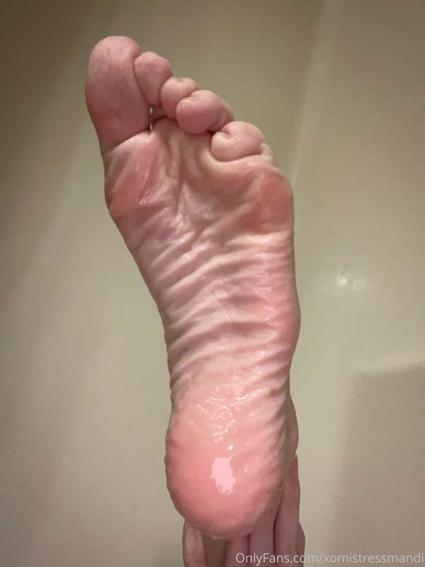 I took some photos after my bath of my super wrinkly soles! 1
