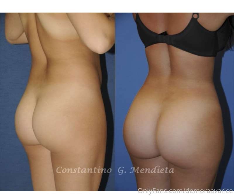 The surgeon wants me to send “wish list” pics of butts... an.. 2