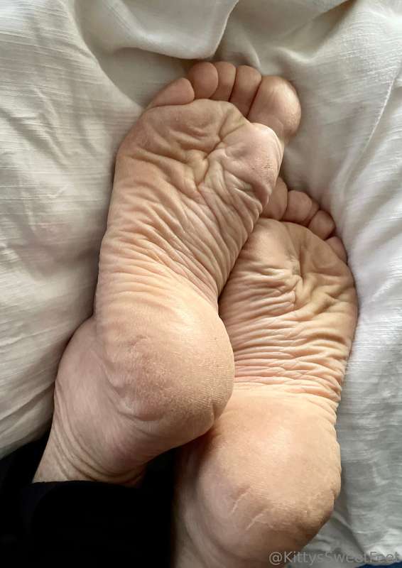 My feet have been through a lot! These wrinkled, dry soles a.. 5