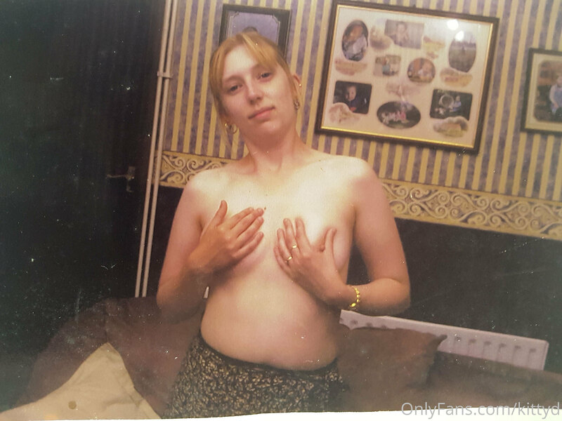 Me at 25 and now. My tits have grown back, they were always .. 6