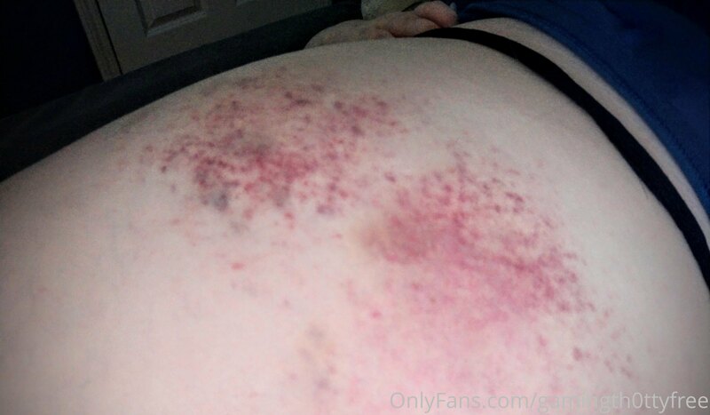 People messaging me asking about the bruises on my ass, yes ..