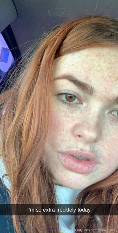 Such a freckled face!