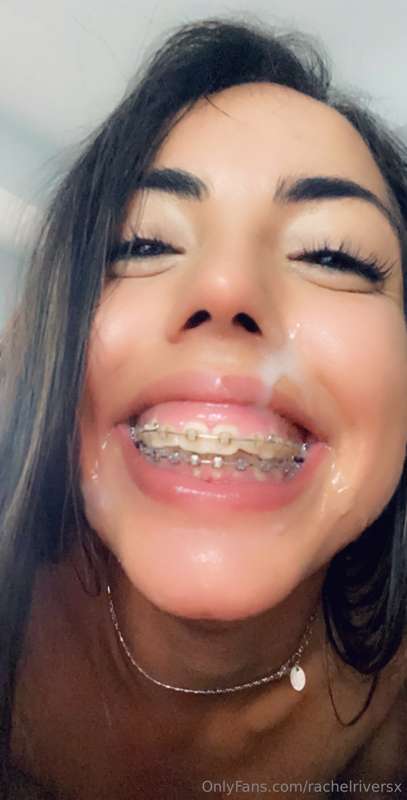 NUDE BRACES PHOTO SET! from over the years💕 15