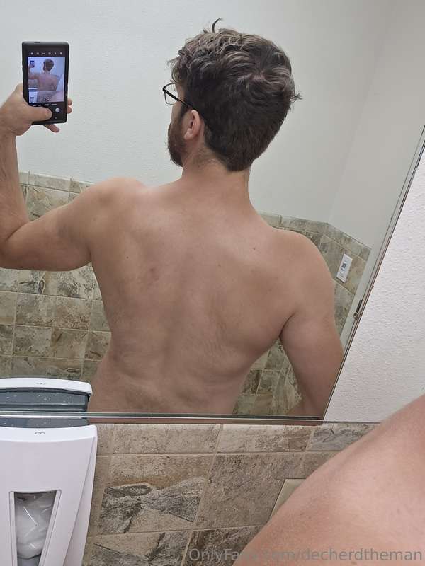 Look at all these bite marks! (Bonus sfw selfie) 2