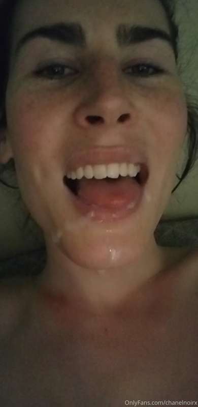 Post facial