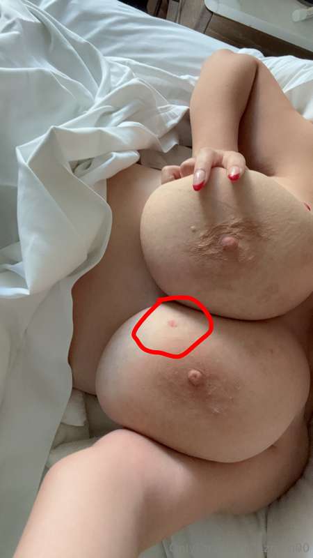 Zipper got caught in my titty. Who wants to kiss my booboo? 