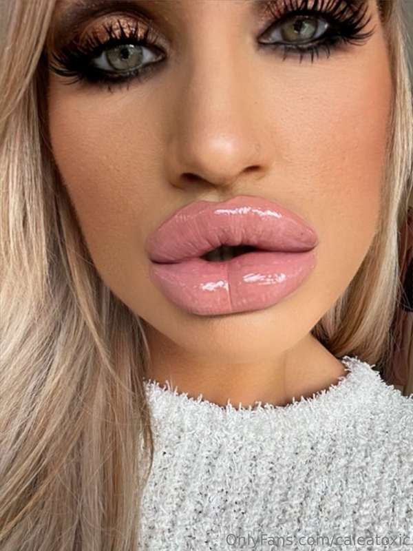 First of all, I had my lips injected even bigger. So the wee..