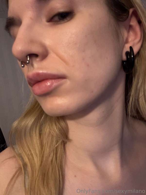Sorry looking very dead after my lipfillers and my sleep hav..