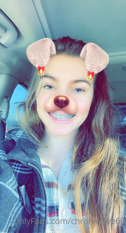 Last selfies with braces on 🥺💓 & vid of them coming off! I’m.. 1