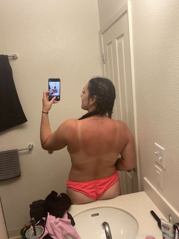 Got a little burnt today 😅