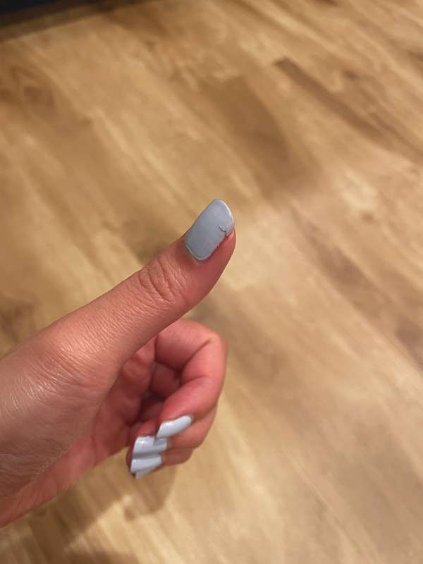 ✅  2nd COVID shot 
✅  Broke my nail
✅  Bitten by spider

Sti.. 2