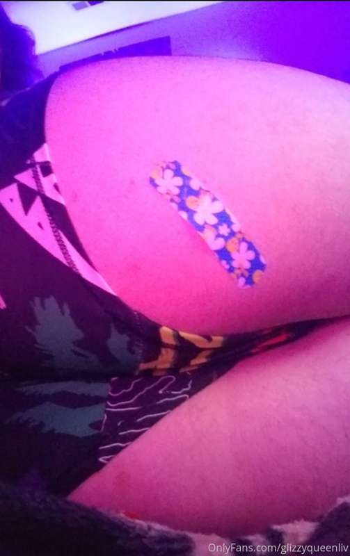 Had a boo-boo on my butt this day but still looked cute uwu