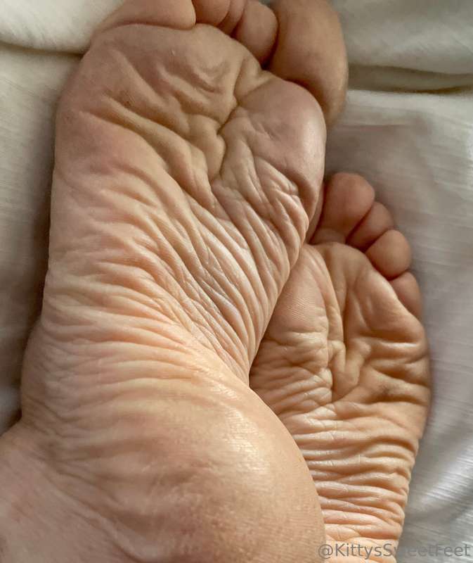 My feet have been through a lot! These wrinkled, dry soles a.. 7