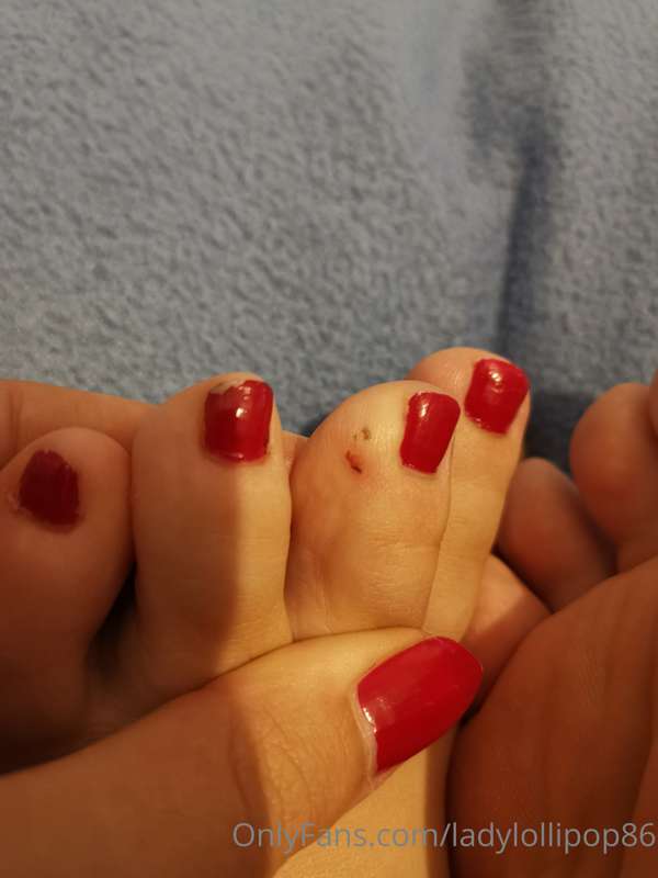 Ouch 😢