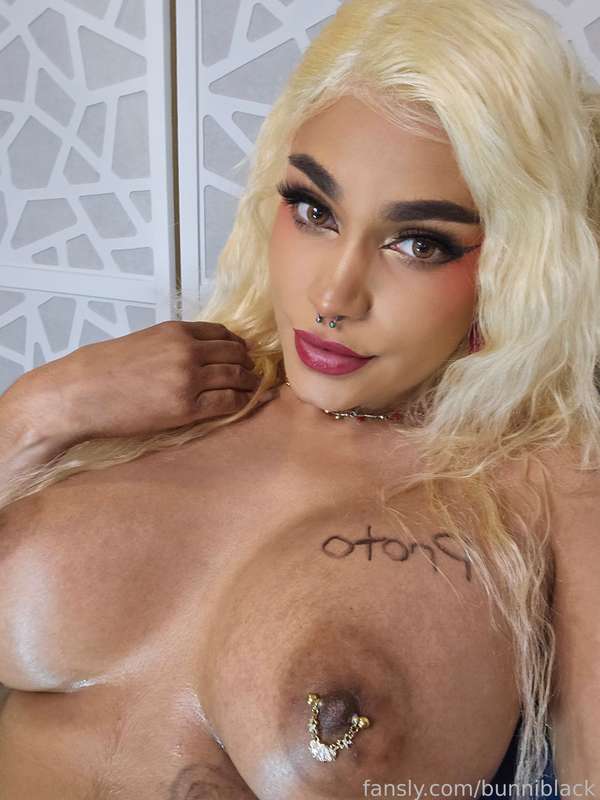 DM 1