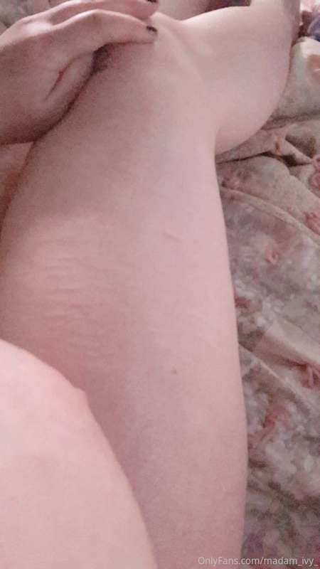 Tw. Self harm scars

.
 
. 

.


So these pics have angles, .. 7
