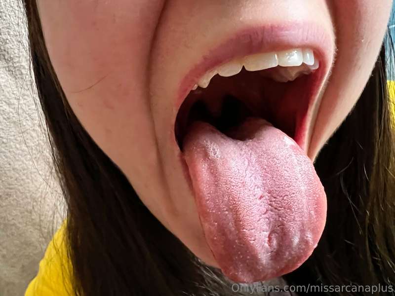 (1-12) I'm ready for my remote dental exam ahhhhhhhhhh
This .. 11