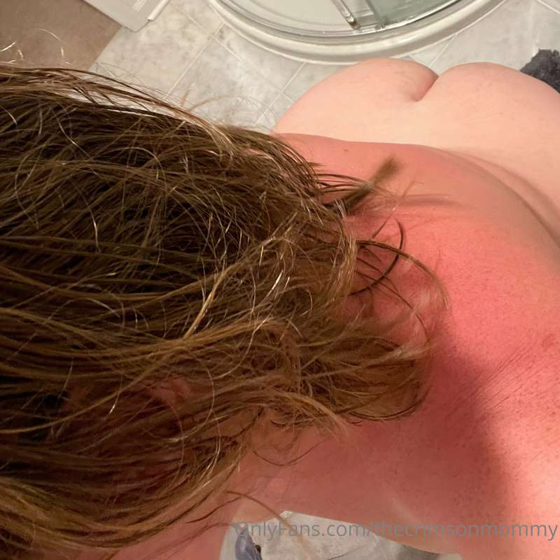 Mommy may have spent a little too much time in the sun today.. 4