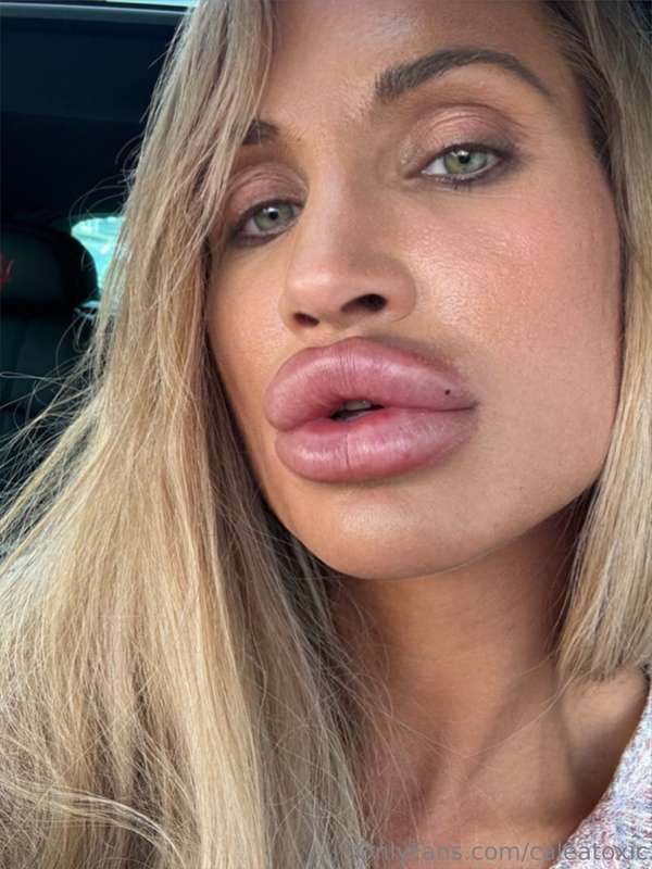 Fresh from lip spraying - I love it! 💋 1