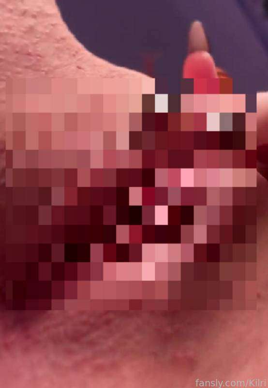 DM