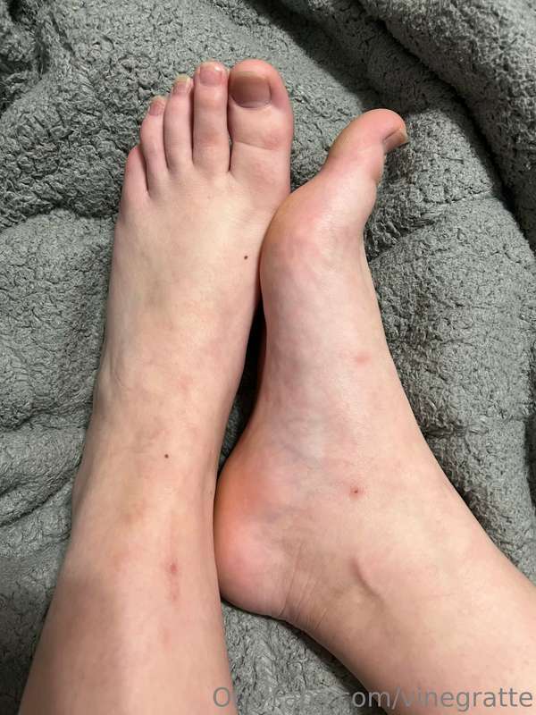 Tiny feet 🥹 1