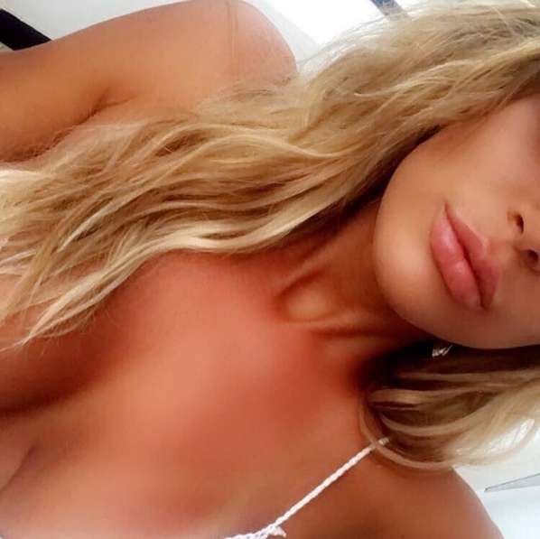 Sun kissed 👄☀️