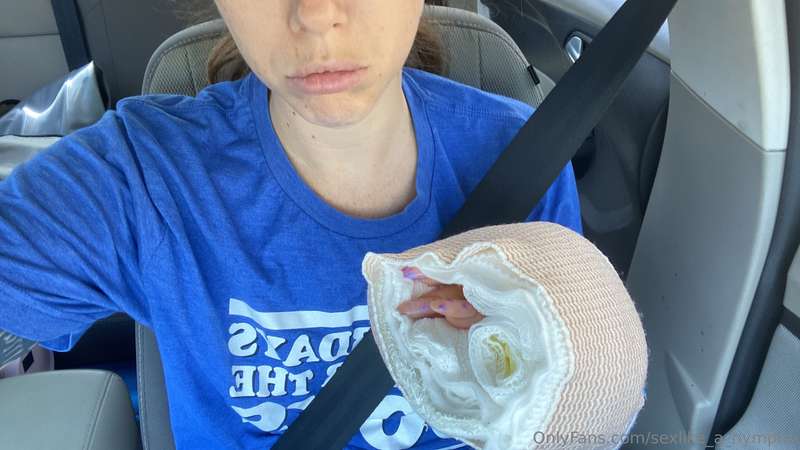Surgery complete definitely could use a reason to smile righ..