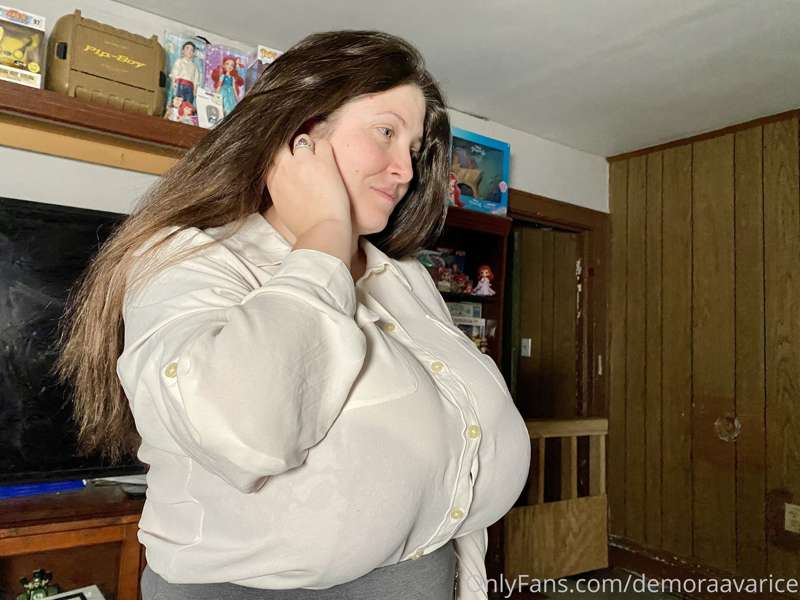 Random news: next surgery pretty much 50% paid for now!

Her.. 34
