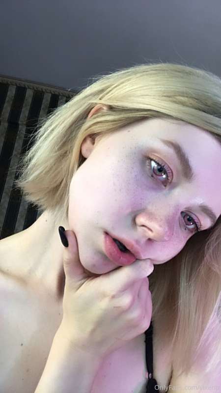 Gonna bite you hurt