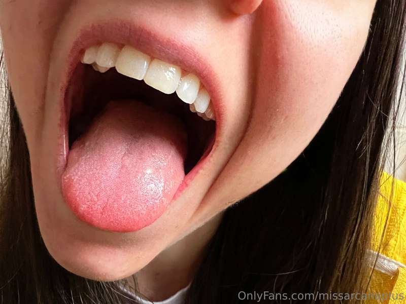 (1-12) I'm ready for my remote dental exam ahhhhhhhhhh
This .. 3