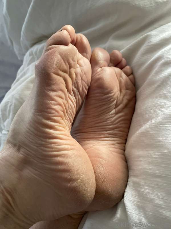My feet have been through a lot! These wrinkled, dry soles a.. 3