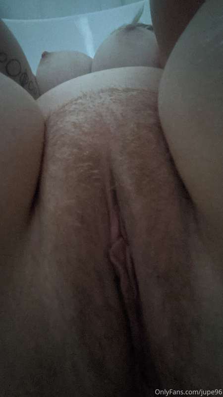 Harry or bald 🐱?? 2