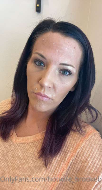 Before and after Botox and lip filler day last week. I absol..