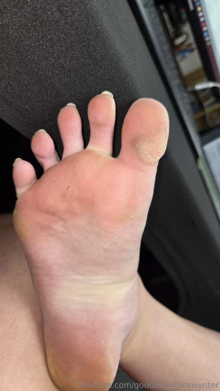 Sweaty calluses ready for your nose and mouth😼😈 6
