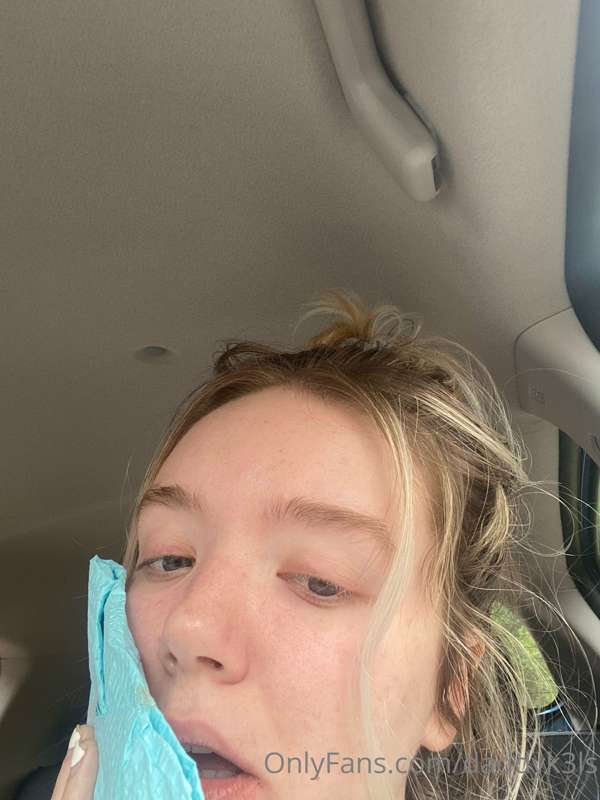 got my wisdom teefs out🥺🦷💕
