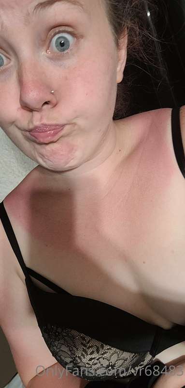 Got a little sun burnt today!! Ops.. maybe a shower live who.. 1