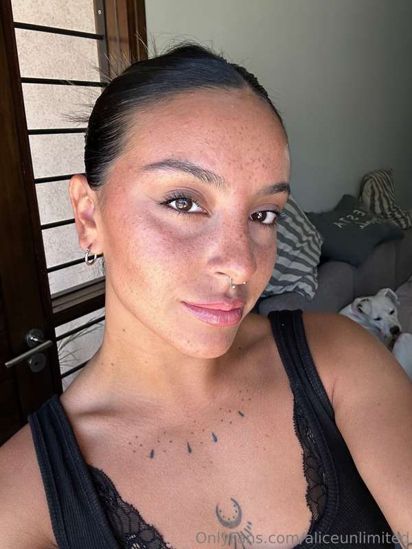 Do u like freckles?👀