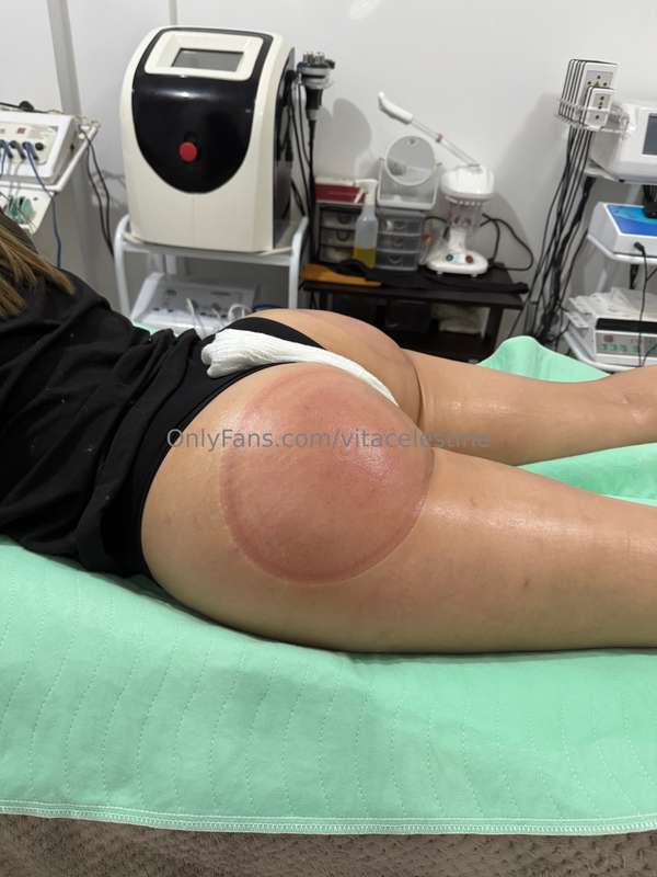 Ayer me hicieron masajes en las nalgas jajajaja Miren cómo q.. 1