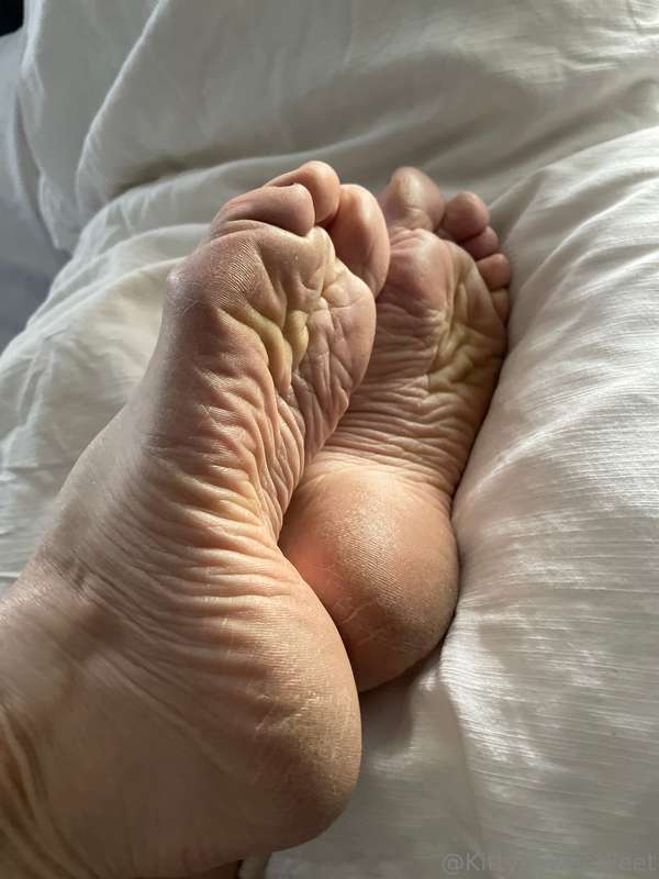 My feet have been through a lot! These wrinkled, dry soles a.. 4