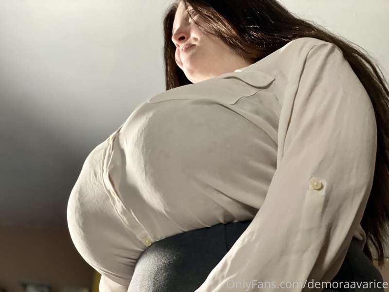 Random news: next surgery pretty much 50% paid for now!

Her.. 2