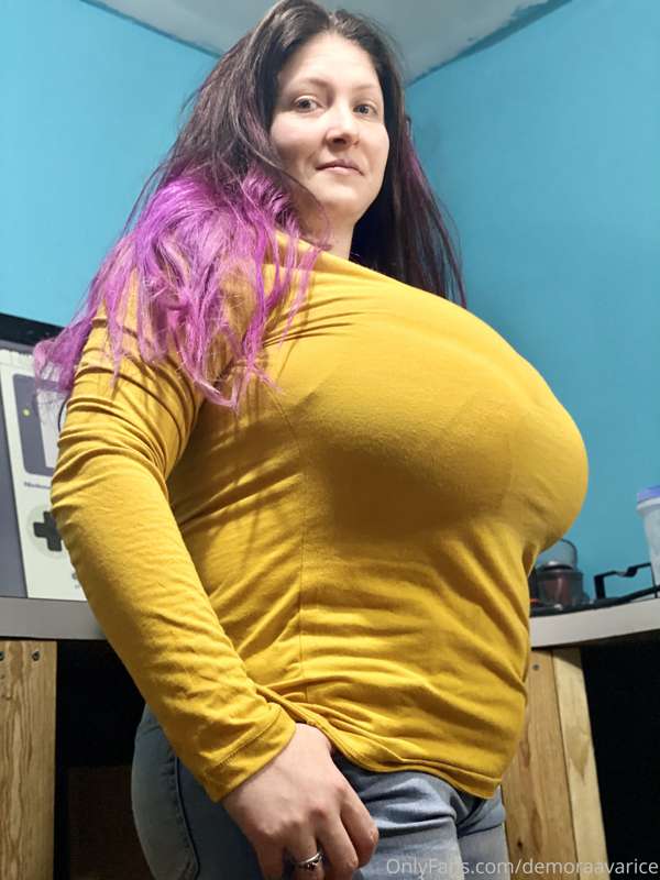 So yea. Definitely going with another fat transfer. Also goa.. 1