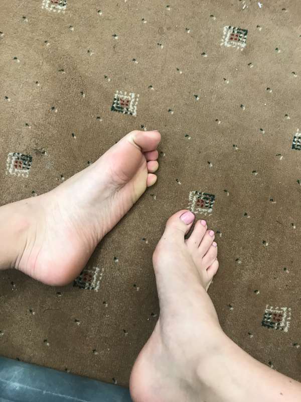 So much bare foot!!  1