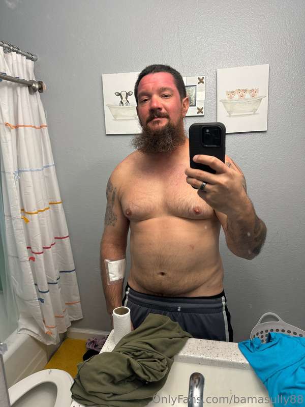 Slightly sunburnt lol, in my defense tho welding already sea..