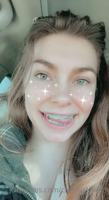 Last selfies with braces on 🥺💓 & vid of them coming off! I’m.. 3