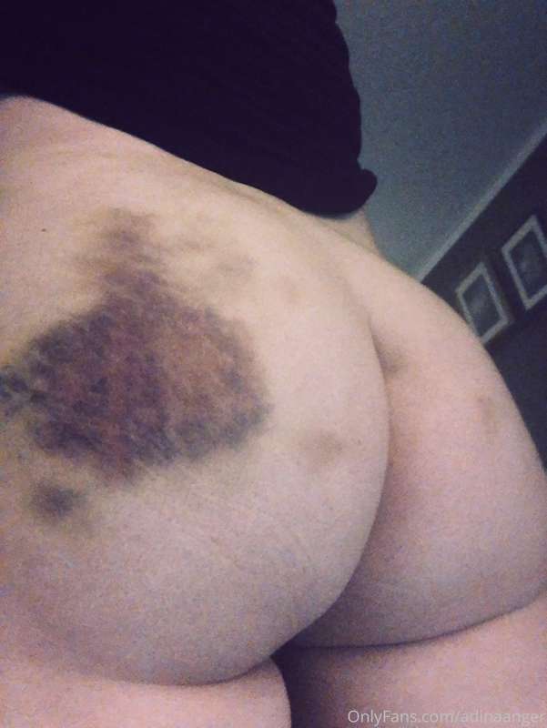 the aftermath.
it hurts and I love it.