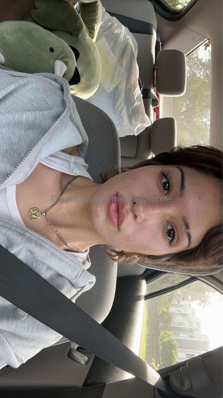 Guess who got some lip filler hehee 1